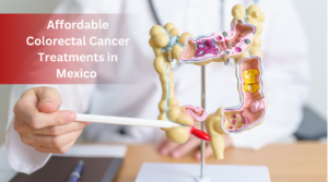 Affordable Colorectal Cancer Treatments in Mexico