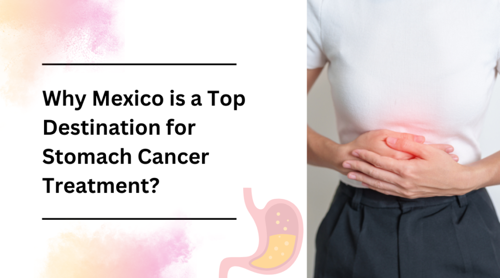 Why Mexico is a Top Destination for Stomach Cancer Treatment