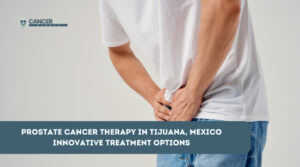 Prostate Cancer Therapy in Tijuana, Mexico: Innovative Treatment Options