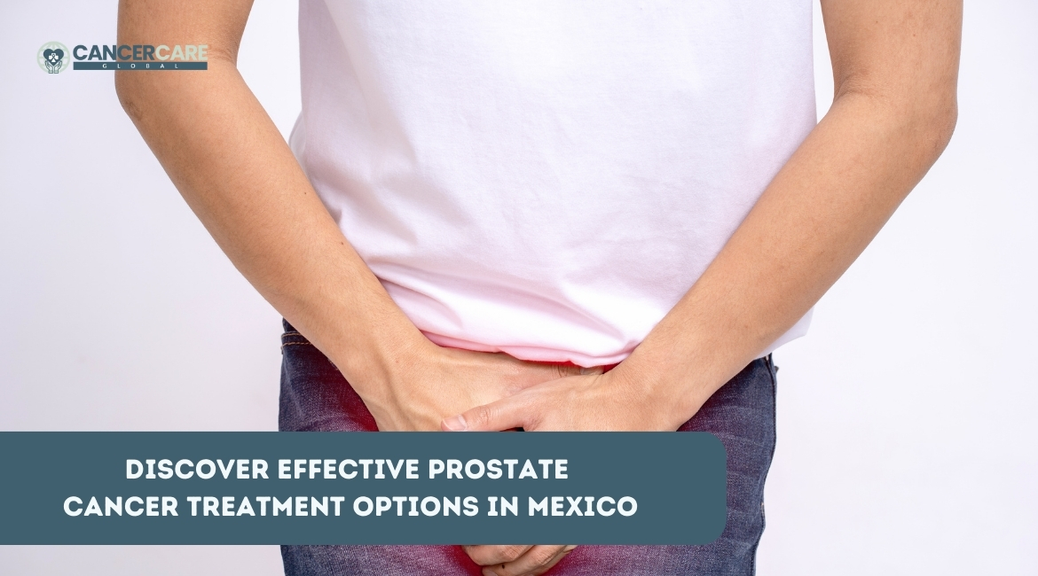 Read more about the article Discover Effective Prostate Cancer Treatment Options in Mexico: Your Comprehensive Guide