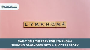 CAR-T Cell Therapy for Lymphoma Turning Diagnosis into a Success Story