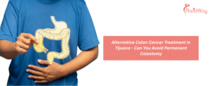 Alternative Colon Cancer Treatment in Tijuana - Can You Avoid Permanent Colostomy