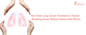 Non-Toxic Lung Cancer Treatment in Tijuana - Breathing Easier Without Chemo Side Effects
