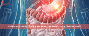 Alternative Stomach Cancer Treatment in Tijuana - Restoring Digestive Health