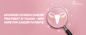 Advanced Ovarian Cancer Treatment in Tijuana - New Hope for Cancer Patients