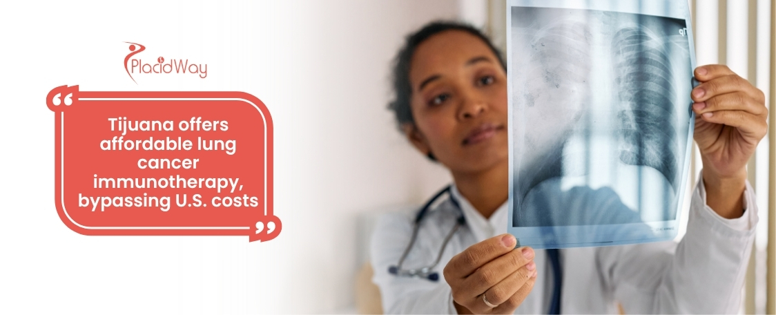 Read more about the article Bypassing the ‘Financial Toxicity’ of U.S. Healthcare: Affordable Lung Cancer Immunotherapy Surges in Tijuana, Mexico